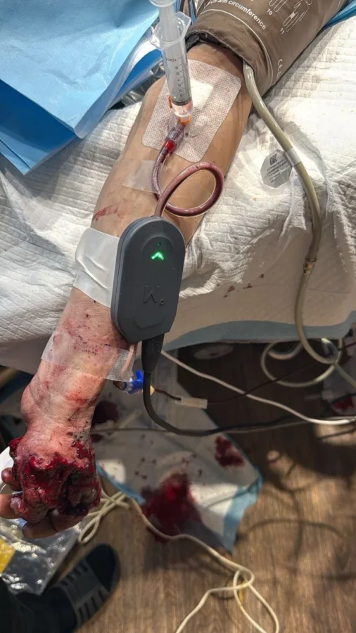 Leverer utstyr for livreddende behandling i felt