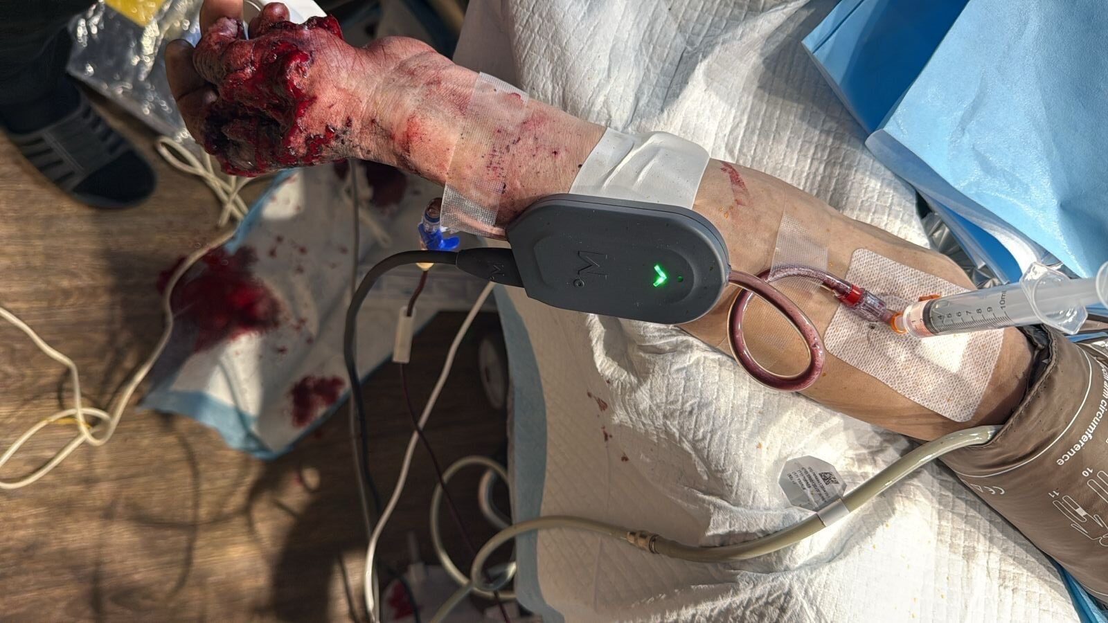 Blood transfusion equipment to 4th SOF - Fritt Ukraina